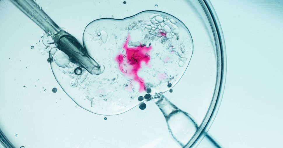 Social Freezing : congeler ses ovocytes pour repousser la maternité